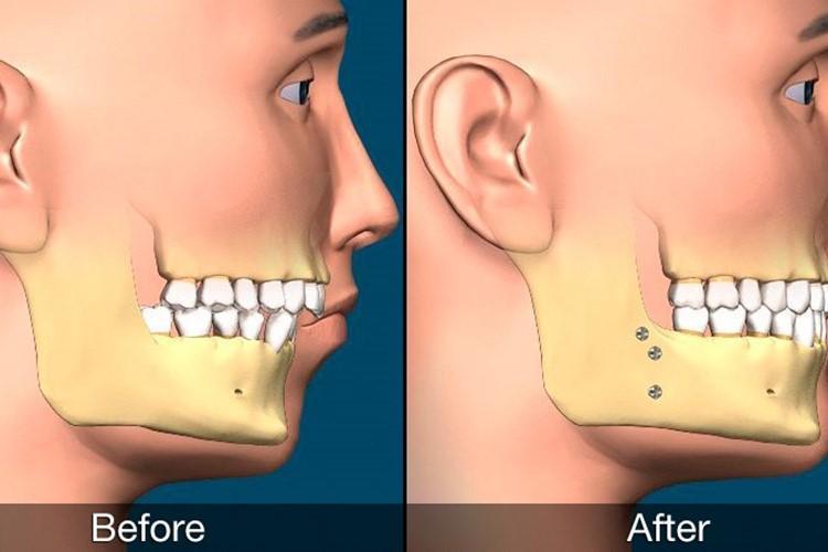 برخورداری از بهترین درمان ها در جراحی های دهان، فک و صورت
