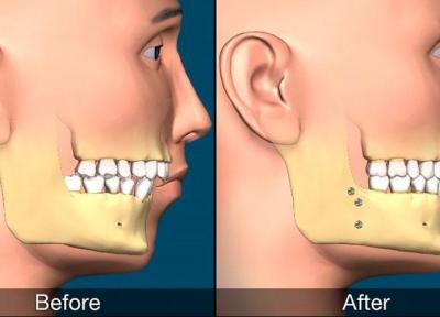برخورداری از بهترین درمان ها در جراحی های دهان، فک و صورت